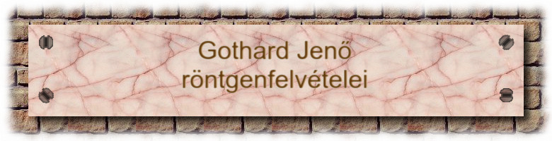 Gothard Jenő röntgenfelvételei